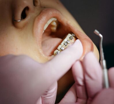 Patient receives a Treatment from a Dentist